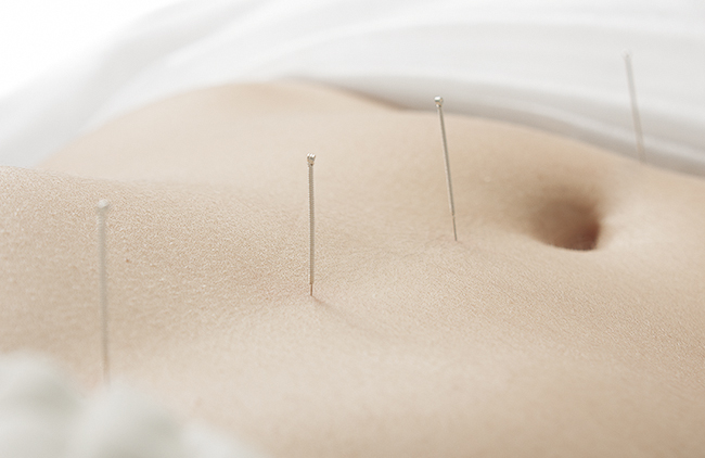 La acupuntura como remedio para mejorar la fertilidad