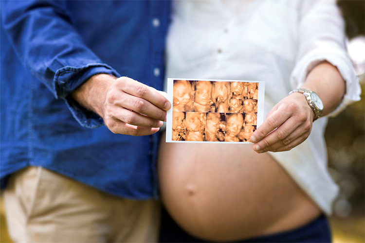 ¿Cuándo es el mejor momento para hacer una ecografía prenatal 4D?