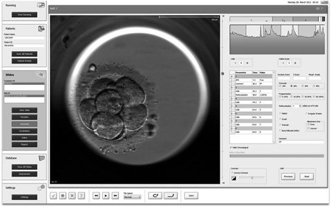 ¿Cómo funciona exactamente el EmbryoScope?