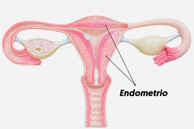 En qué consiste la obstrucción de las trompas uterinas
