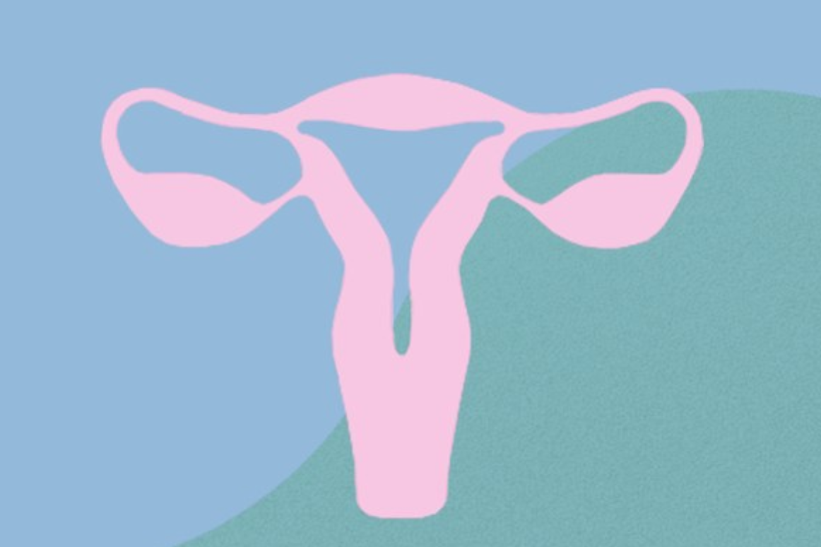 Endometriosis: entender una infertilidad inexplicable