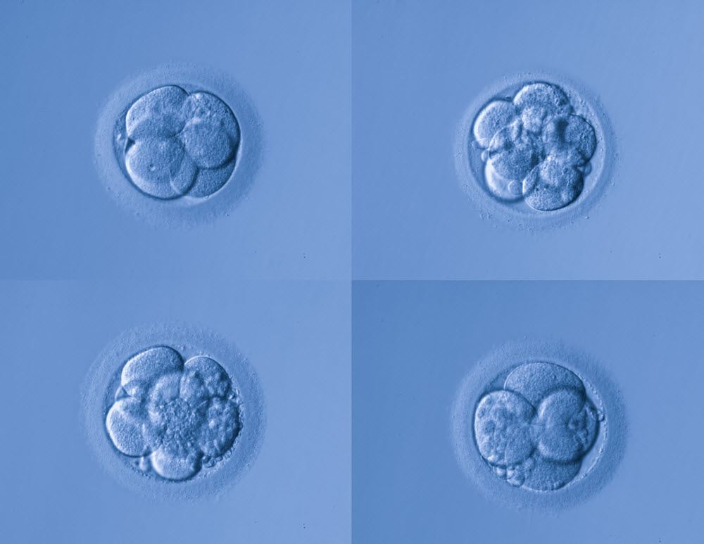 Clasificación de embriones y blastocitos - ¿Cómo funciona?
