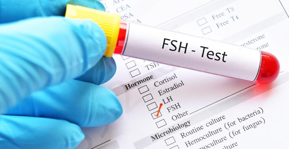¿Cómo afectan los niveles de FSH a la fertilidad?