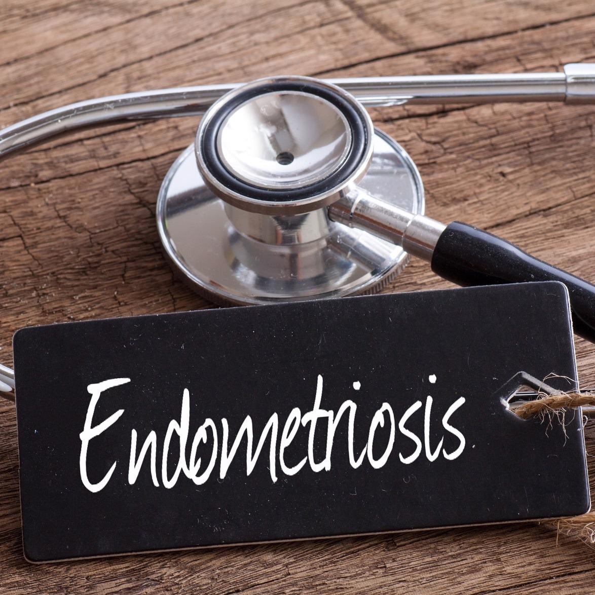 Los ecografistas tardan un 64% más en detectar la endometriosis que en las ecografías pélvicas rutinarias, según un estudio