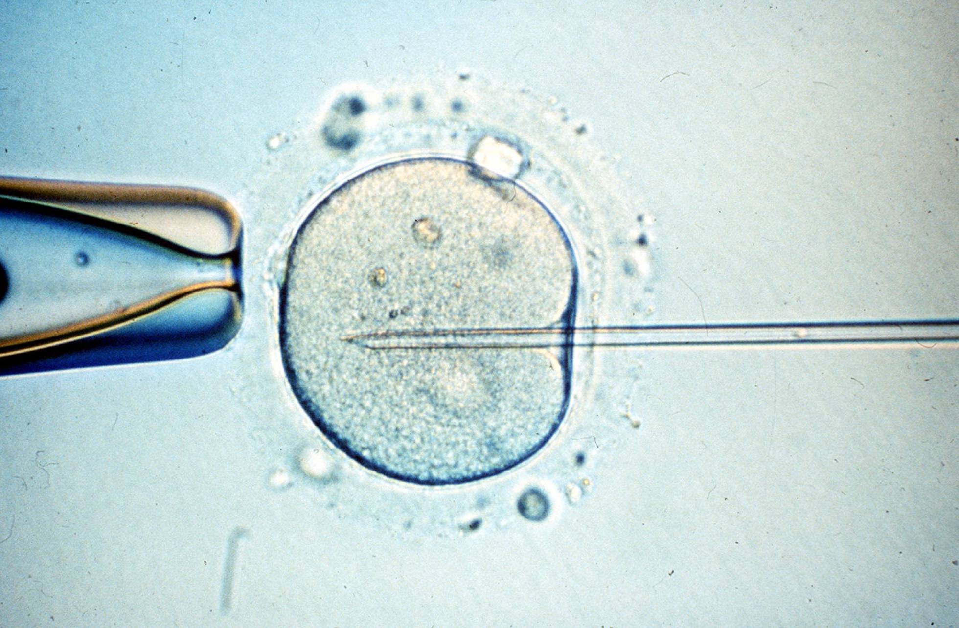 Fecundación in vitro éxito a la primera