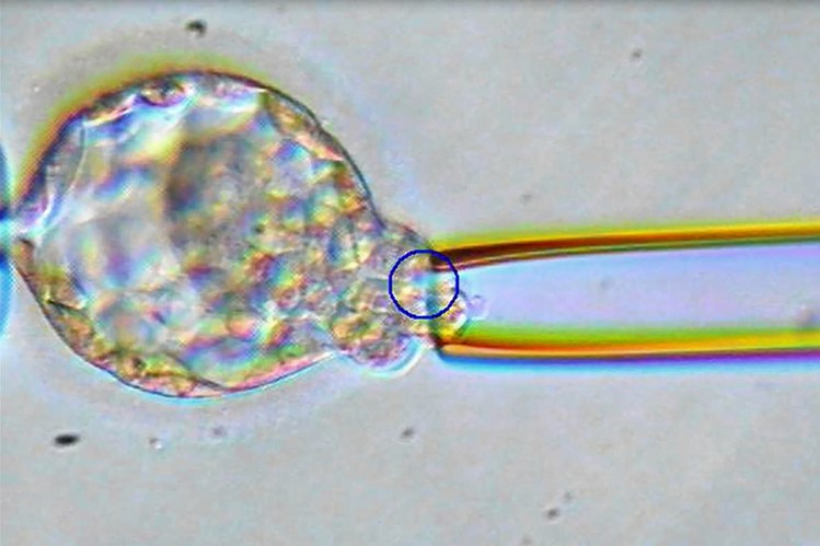 Últimas técnicas de FIV: Fecundación In Vitro.