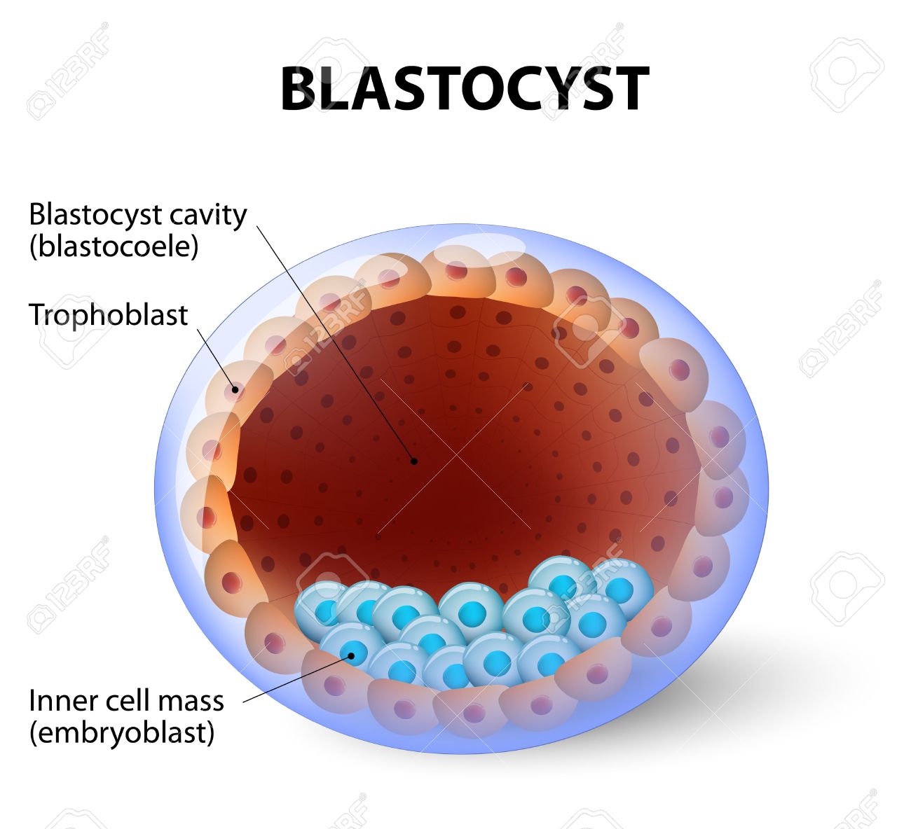 ¿Qué es una transferencia en blastocisto?