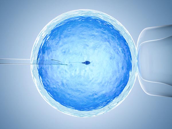 Inyección intra citoplasmática de espermatozoides seleccionados (IMSI)