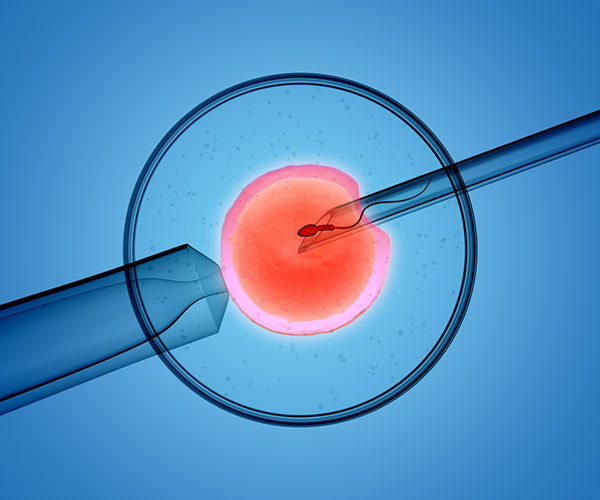 Últimos avances: Inyección intra citoplasmática de espermatozoides seleccionados (IMSI)