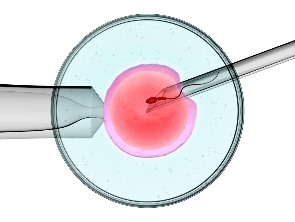 En qué consiste la FIV con ICSI