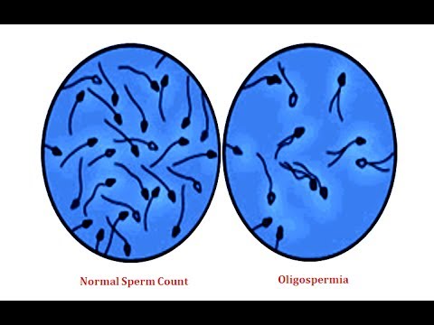 Qué es la oligospermia