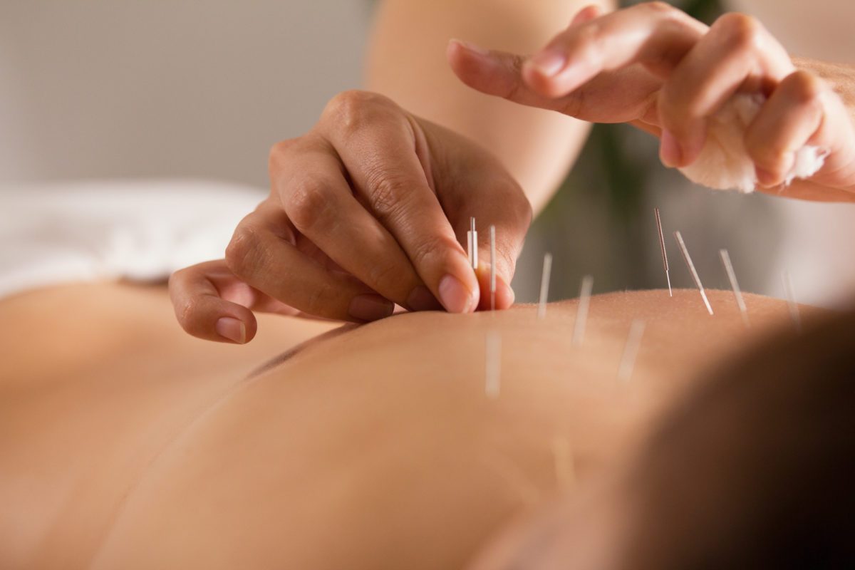 ¿Puede la acupuntura mejorar la fertilidad?