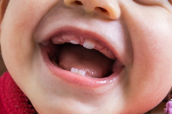 Los dientes de leche y el origen del autismo
