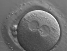 Zona pellucida single cell embryo