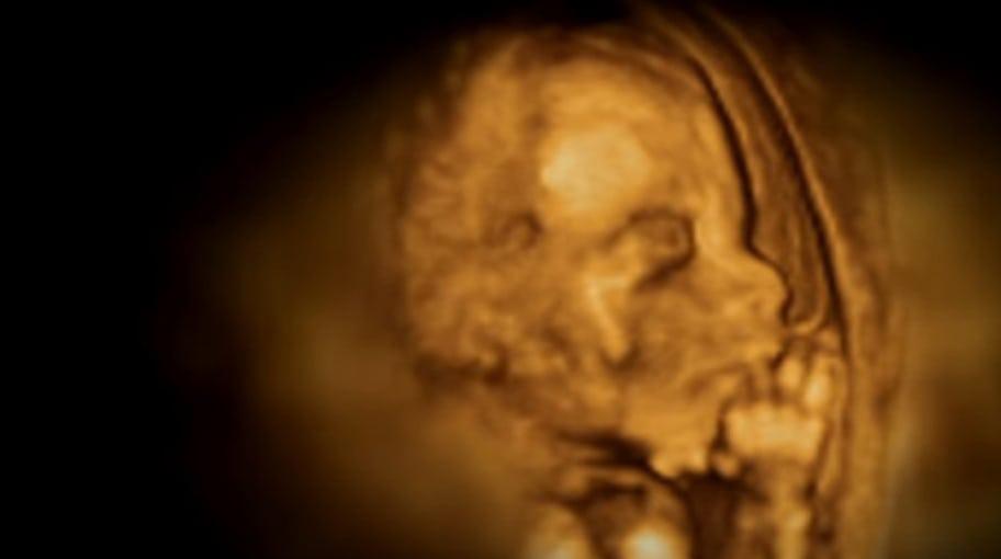 ¿Qué ocurre en el útero durante el embarazo?