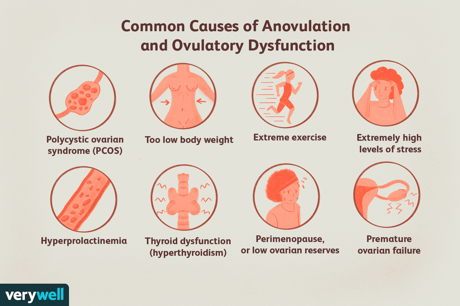 Anovulación y disfunción ovulatoria