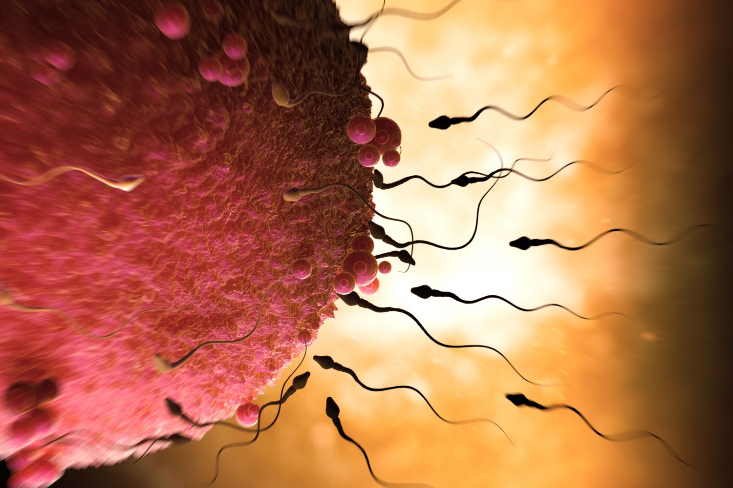 ¿Cómo se trata el recuento de espermatozoides y la motilidad bajos?