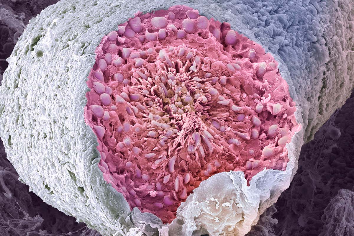 El esperma cultivado en laboratorio podría permitir a los hombres infértiles tener hijos editados genéticamente