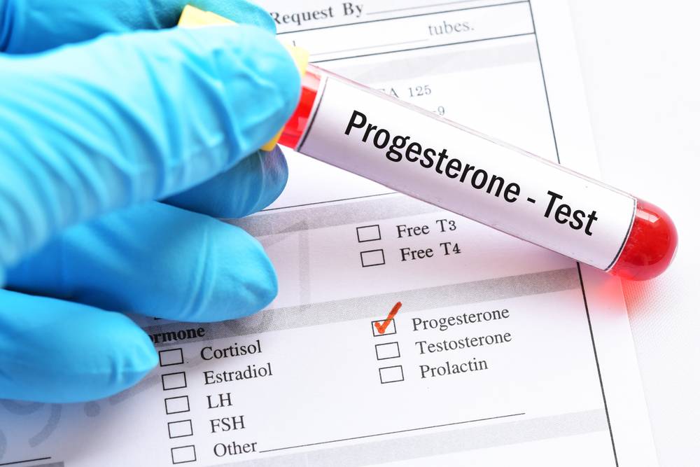 La progesterona baja y la deficiencia de la fase lútea