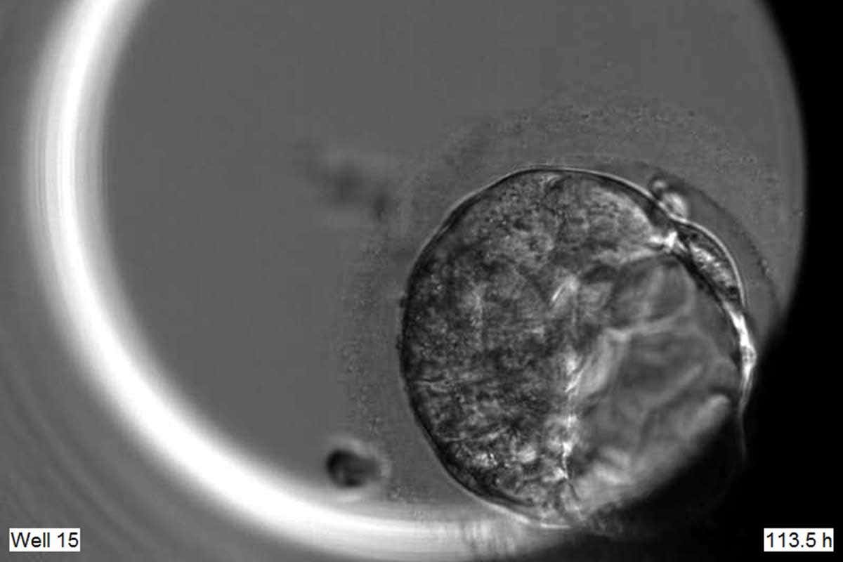 ¿Por qué un equipo del Reino Unido ha editado genéticamente embriones humanos?