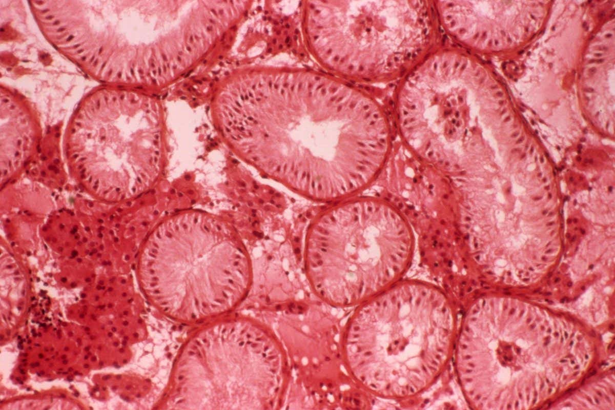 Pequeñas burbujas en el semen podrían contribuir a la 'infertilidad inexplicable'