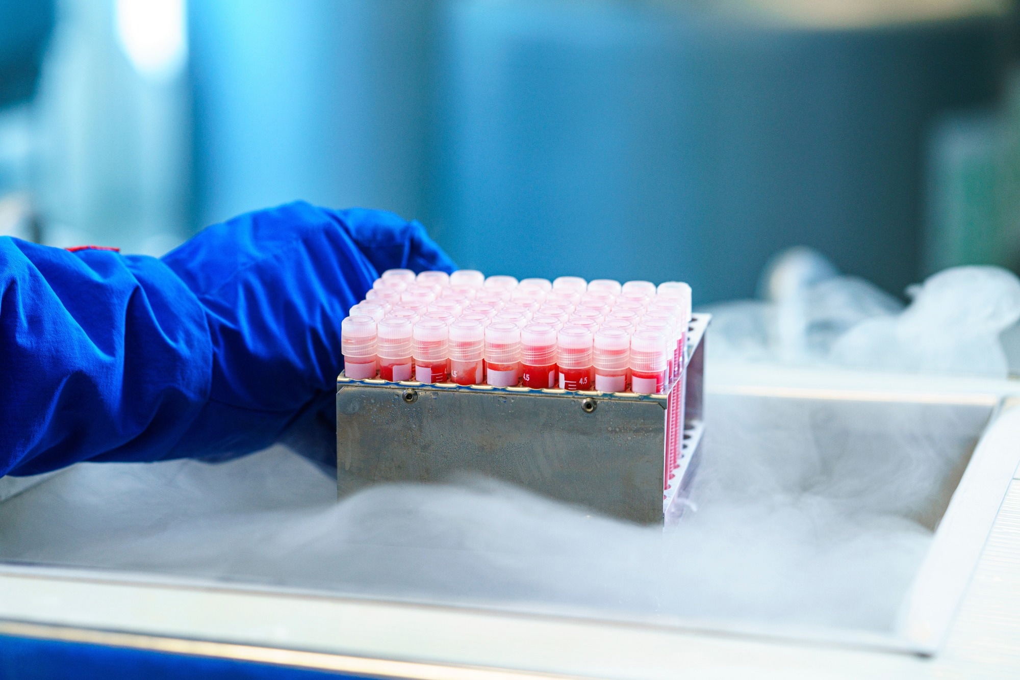 Study: Validation of a SARS-CoV-2 RT-PCR assay: a requirement to evaluate viral contamination in human semen. Image Credit: Leonidovich/Shutterstock