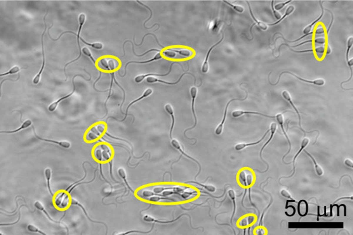 Los espermatozoides se mueven en manada como ciclistas para atravesar el espeso flujo vaginal