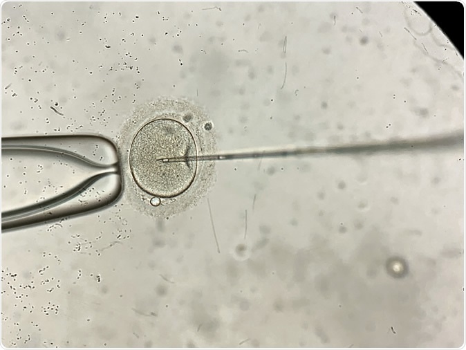 Macro view through the microscope at process of the in vitro fertilization of a female egg inside IVF dish in the laboratory. Image Credit: Bezikus / Shutterstock