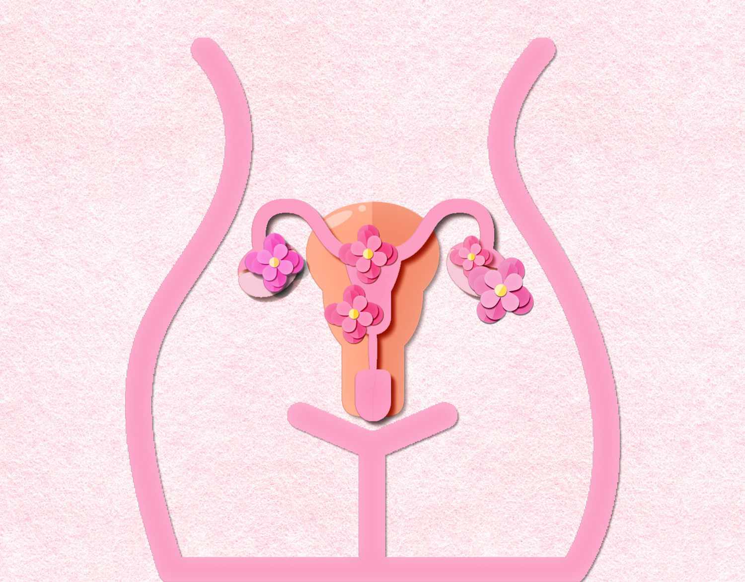 4 cosas que hay que saber sobre el síndrome de ovario poliquístico y la fertilidad