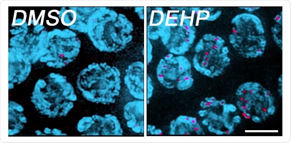 Common plasticizer leads to fertility problems in roundworms