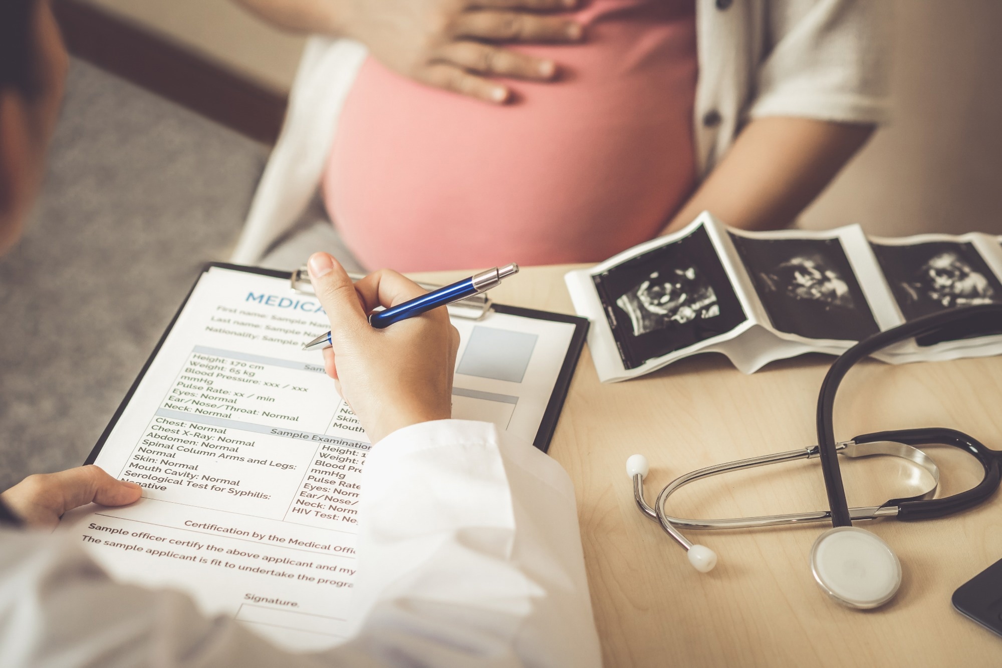 ¿Se asocia la recepción de un tratamiento de infertilidad con la hospitalización por ictus?