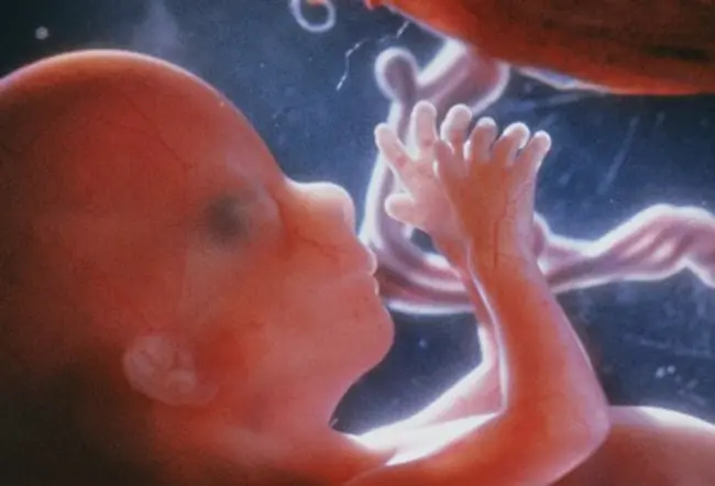 Imagen de un feto humano.