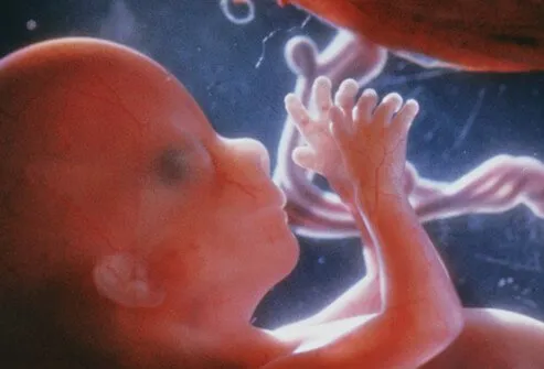 El feto humano a aproximadamente cuatro meses mostrando la cabeza y las extremidades superiores y el cordón umbilical que conecta el feto (en el ombligo) con la placenta.