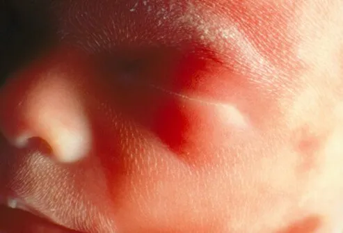 Feto humano a aproximadamente 24 semanas mostrando detalles de sus ojos cerrados, nariz, boca y vello facial.